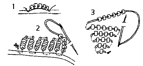 Obr.1 - Steh line zeny